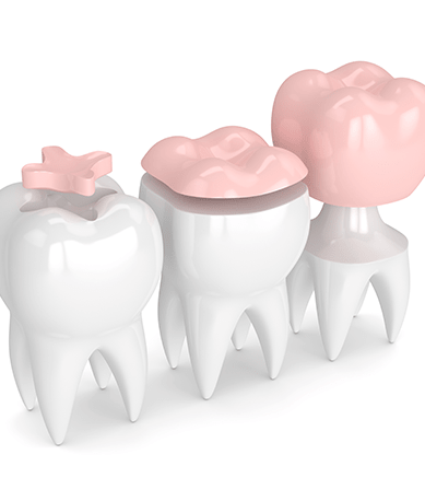 Treatment - Silk Dental