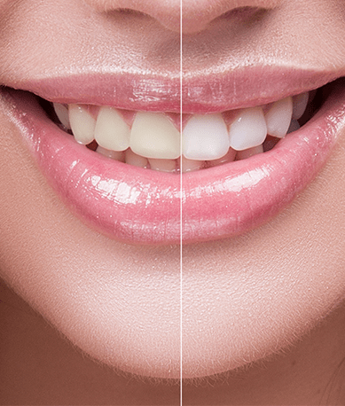 Treatment - Silk Dental