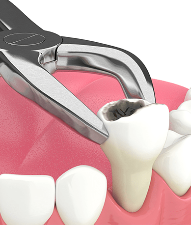 Treatment - Silk Dental