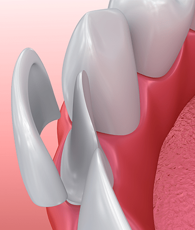 Treatment - Silk Dental